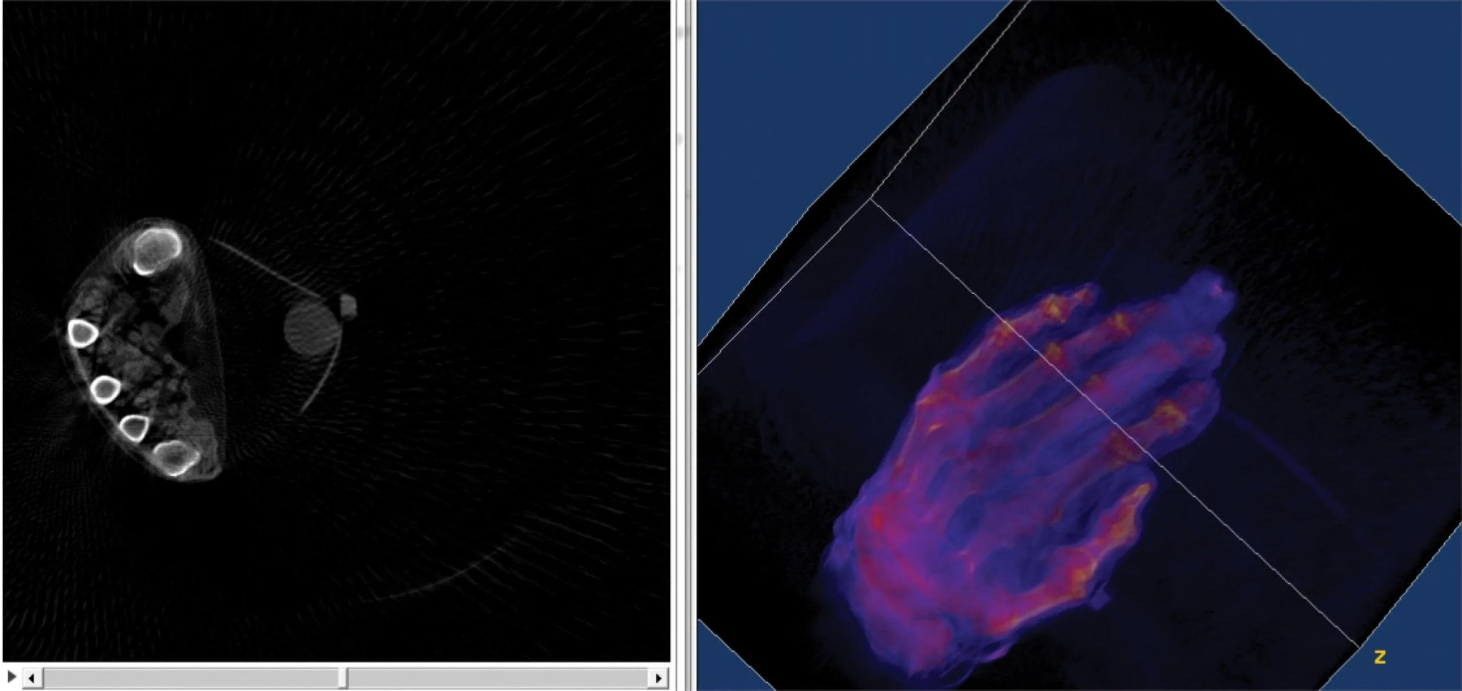 Imagen de la ecografía de una mano humana obtenida por el equipo de investigación del doctor Raj Gupta durante las pruebas de la nueva tecnología de exploración por tomografía computarizada. Créditos: Raj Gupta, Hospital General de Massachusetts y Facultad de Medicina de la Universidad de Harvard